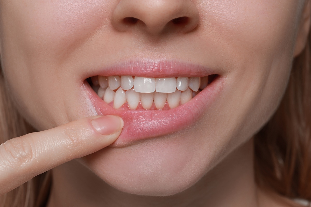 How long can you go without getting a root canal blog