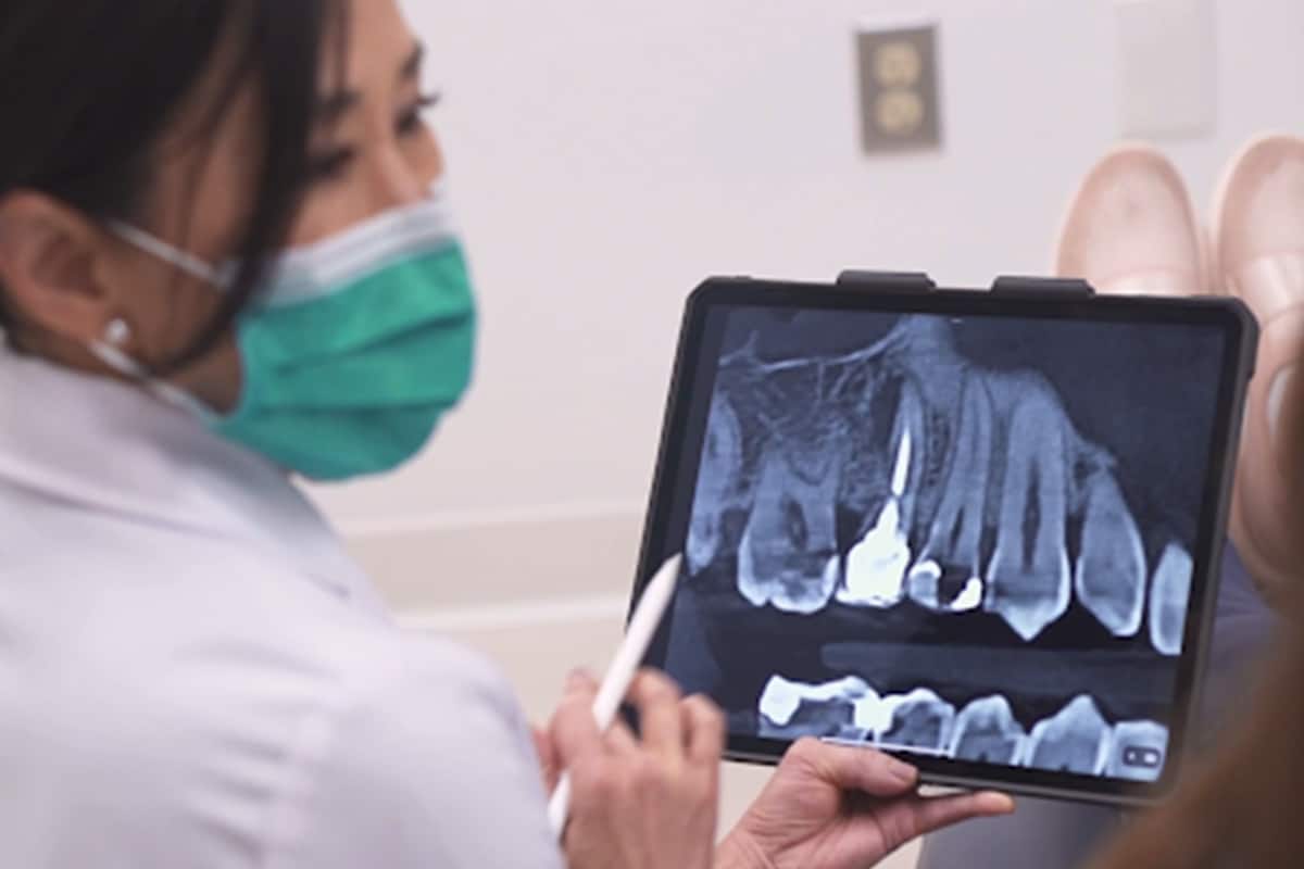How technology enhances success in root canal treatments blog